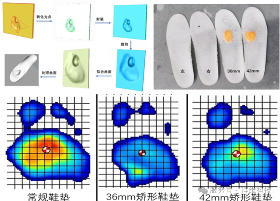 3D Systems定制化矫形鞋垫
